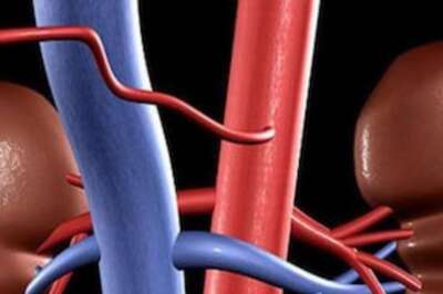 Kanpur Man Has 3 Kidneys, Doctors Say It's Rare But Nothing to Worry