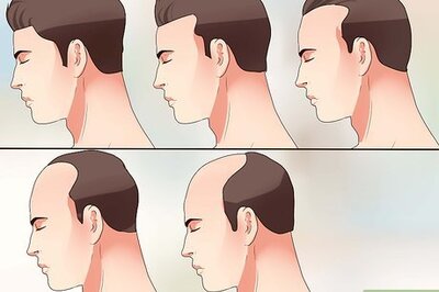 How to Measure Hair Loss