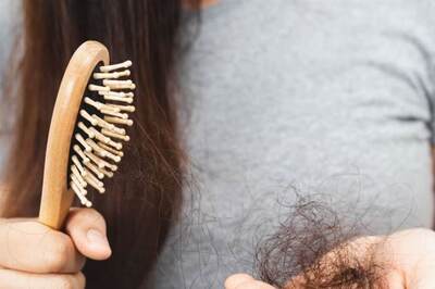 Multifaceted Approaches To Managing PCOS: From Hair Loss To Regrowth