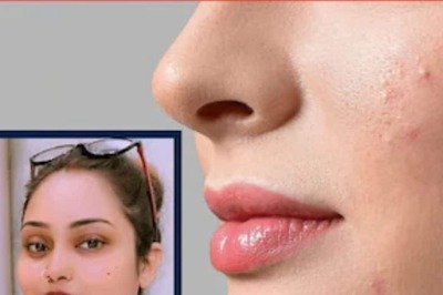 What Is Vitamin B12 Deficiency? Know Symptoms And Tips To Overcome