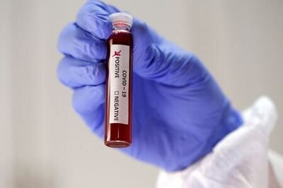 Two European Patients Re-infected With Coronavirus