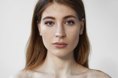 Auto Immune Diseases Rising After COVID-19 Pandemic? Here's What Experts Have To Say