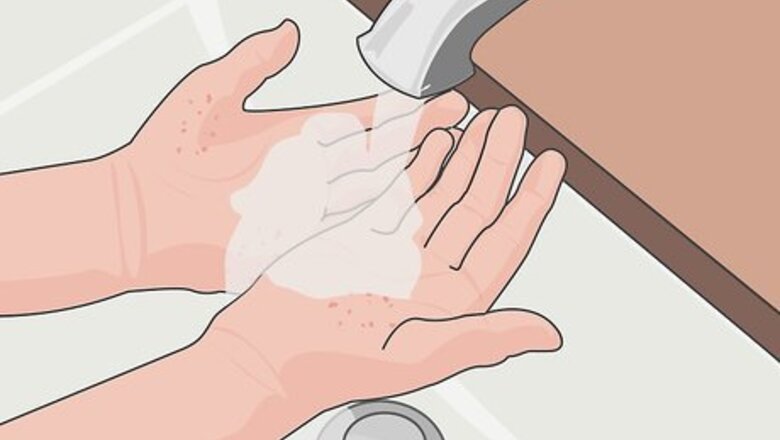 How to Prevent Scarring