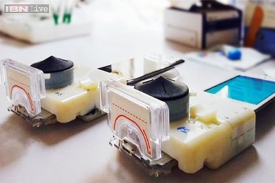 A smartphone device that can diagnose HIV in 15 minutes