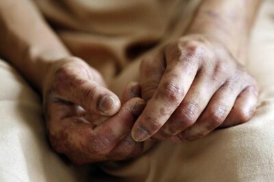 13-year-old Boy Beaten by Coimbatore Cops, SHRC Seeks Report from Police Commissioner