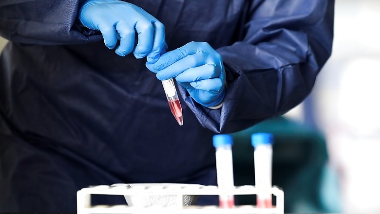 Covid-19: Bengal to Start Plasma Therapy, Blood Component Collected from First Donor