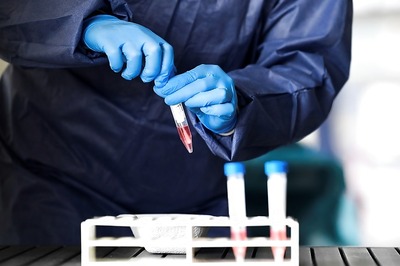 Covid-19: Bengal to Start Plasma Therapy, Blood Component Collected from First Donor