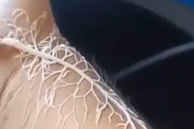 Video Of Ribbon Worm Spitting Out Tree-Like Structure Is Not For Faint-Hearted