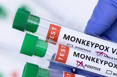 Does Having Multiple Sexual Partners Increase Monkeypox Risk? Experts Clear The Air