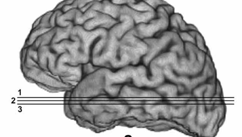 Facebook feature in brain rules social network