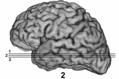Facebook feature in brain rules social network