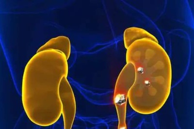 These Home Remedies Can Help To Get Rid of Kidney Stones