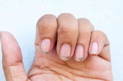 Fingernails May Contain 32 Types Of Bacteria: Here’s How To Keep Them Clean