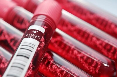 3-Year-Old Diagnosed With Rare And Deadly Amoebic Meningoencephalitis In Kozhikode