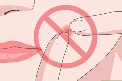 How to Stop a Pimple from Forming