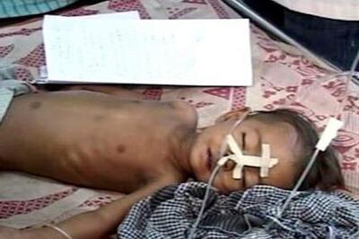 4 more children succumb to encephalitis, toll reaches 202