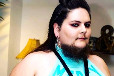 Woman Shaving Face Since Teenage Years Finally Embraces Her Beard