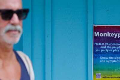 Monkeypox Updates: Recording Biggest One-day Jump, US Reports 1,048 New Cases