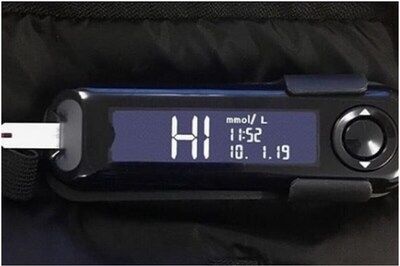 Here are Ways to Control Diabetes While on Dialysis Period