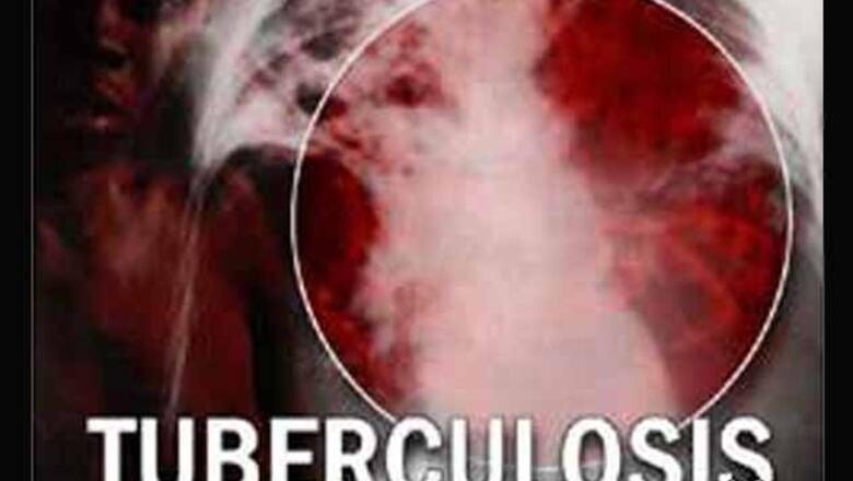 WHO verifies new 100-minTB diagnostic test