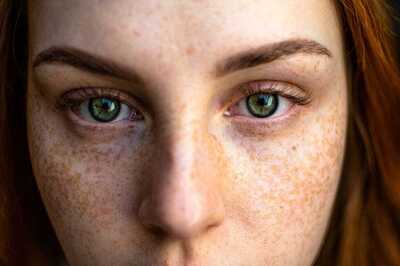 International Skin Pigmentation Day 2024: Home Remedies To Keep Your Face Clean