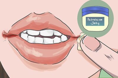 How to Heal Cracks in the Corners of Your Mouth