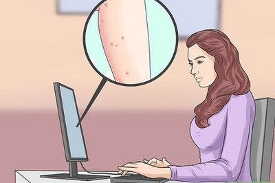 How to Treat Molluscum (Molluscum Contagiosum)