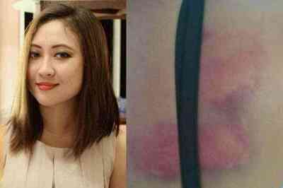 News18 Assam-North East Journalist Gravely Injured in Lathicharge by Police on Assam-Mizoram Border