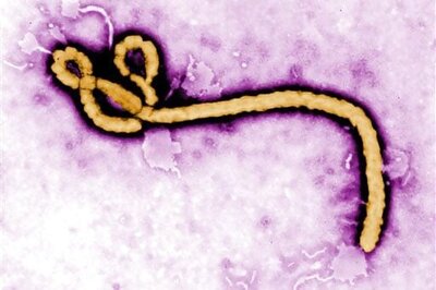 US Study Discovers Human Protein that Might Help Fight Ebola