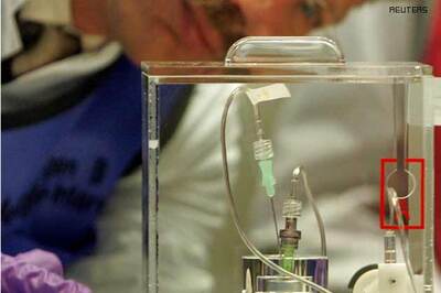 India has the second highest number of Hepatitis B infected