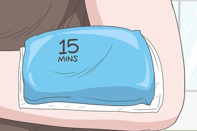 How to Relieve Hives Itching