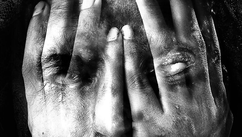 Two Bike-borne men Throw Acid on Schoolgirls in MP