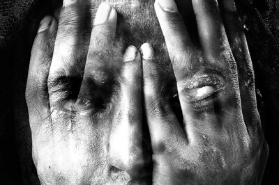 Two Bike-borne men Throw Acid on Schoolgirls in MP