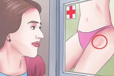 How to Test Yourself for HPV Genital Warts
