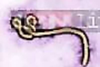 New York doctor who treated patients in Africa tests positive for Ebola