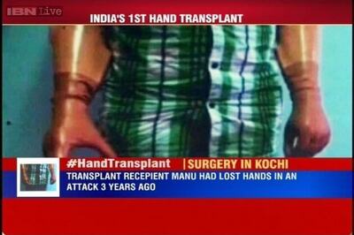 India's 1st double hand transplant conducted on 30-year-old man in Kochi