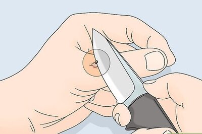 How to Treat Yellow Jacket Stings