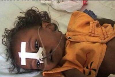 Two more die of encephalitis in Gorakhpur, toll climbs to 237