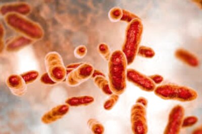 Facts About Brucellosis: The Bacterial Disease Currently Infecting 6,000 in China