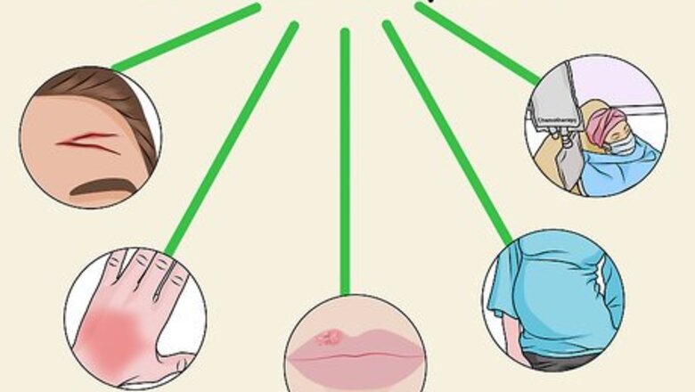 How to Apply a TCA Peel