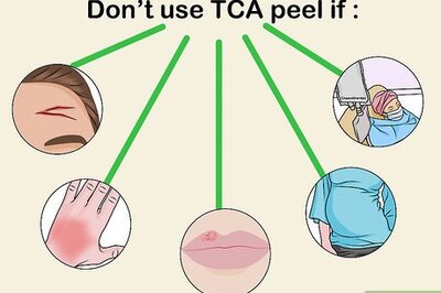 How to Apply a TCA Peel