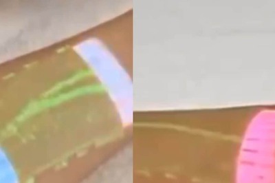 This Infrared Technology To Locate Veins Gets A Thumbs Up From Anand Mahindra