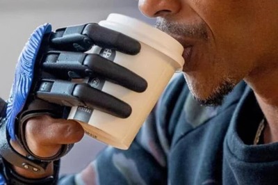 Man, Whose Hand Was Crushed By Meat Grinder, Gets Bionic 3D-Printed Fingers