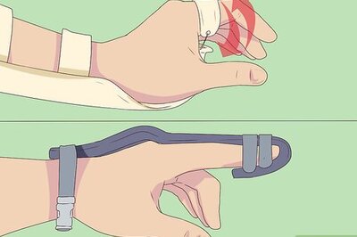 How to Splint a Fractured Hand