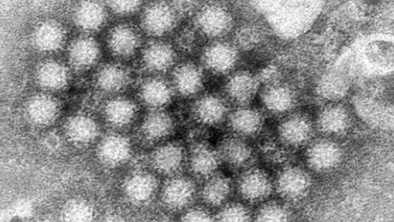 Norovirus scare grounds flight in New Zealand