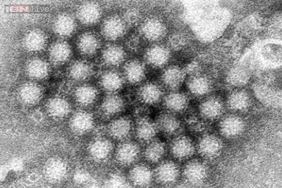 Norovirus scare grounds flight in New Zealand