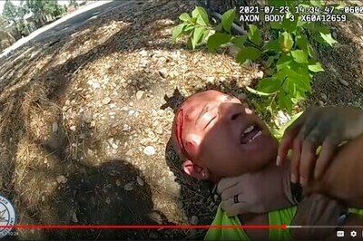 Man Pistol-whipped By Colorado Officer Feared For His Life