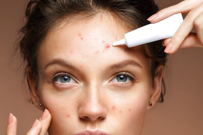High-Risk Cosmetic Ingredients That Can Trigger Severe Acne