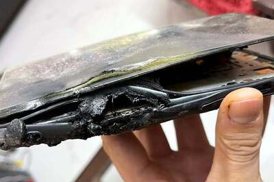 OnePlus Nord 2 User Injured After It Allegedly Exploded During A Phone Call