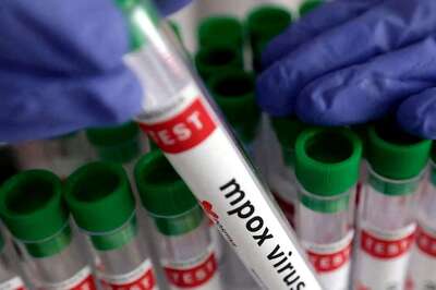 India Reports First Case of Mpox Strain That Led WHO to Declare it Public Health Emergency: Report
